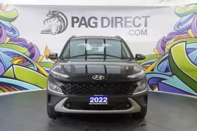 Hyundai Kona * АВТО КРЕДИТ* ЦЕНА ДО БГ * СЕРВИЗНА ИСТОРИЯ * - 36999 лв. / 18917.29 € - 58264751 2 | Car24.bg Hyundai Kona * АВТО КРЕДИТ* ЦЕНА ДО БГ * СЕРВИЗНА ИСТОРИЯ * - 36999 лв. / 18917.29 € - 58264751 2