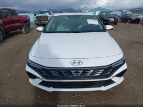 Hyundai Elantra 2.0l Limited - 16500 € / 32271.19 лв. - 54937703 13 | Car24.bg Hyundai Elantra 2.0l Limited - 16500 € / 32271.19 лв. - 54937703 13