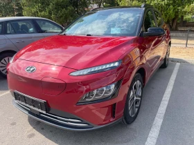 Hyundai Kona 50х.км.Bluelink - 20100 € - 74909797 2
