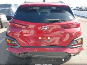 Hyundai Kona 2.0L I-4 DOHC, VVT, 147HP Front Wheel Drive, снимка 11