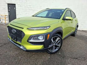 Hyundai Kona 4x4* ULTIMATE* HEAD-UP АвтоКредит(ЦЕНА ДО БГ), снимка 1