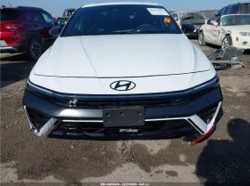 Hyundai Elantra N - BOSE - DISTRONIC - ALCANTARA - ПОДГРЕВИ | Auto.bg — изображение 2
