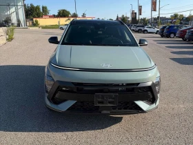 Hyundai Kona N Line Ultimate | CARFAX | АВТОФИНАНСИРАНЕ, снимка 2