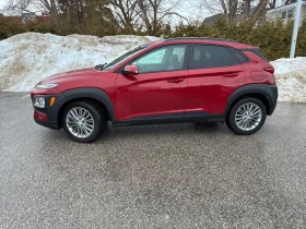 Hyundai Kona * Luxury * CARFAX * БЕЗ ПЪРВОНАЧАЛНА ВНОСКА - 18000 € / 35204.94 лв. - 71639770 2