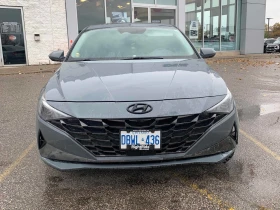 Hyundai Elantra * Luxury * CARFAX * БЕЗ ПЪРВОНАЧАЛНА ВНОСКА - 36050 лв. / 18432.07 € - 53699737 6