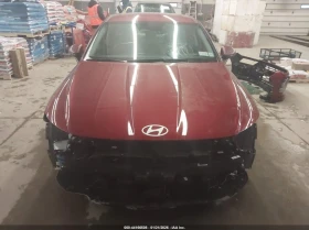 Hyundai Accent 2.0L I-4 DI, DOHC, VVT, 150HP Front Wheel Drive | Auto.bg — изображение 13