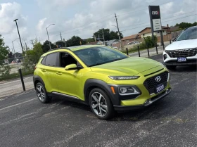 Hyundai Kona 1.6T Ultimate AWD* CARFAX* ОПЦИЯ ЗА ФИНАНСИРАНЕ* , снимка 3