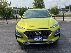 Hyundai Kona 1.6T Ultimate AWD* CARFAX* ОПЦИЯ ЗА ФИНАНСИРАНЕ* , снимка 2